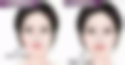 三、国产与进口补片真实花销详解