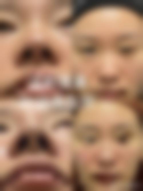长沙天心皕诚和隽医疗美容诊所擅长项目。