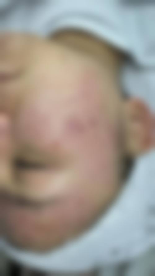all医院治疗反馈与口碑评价。