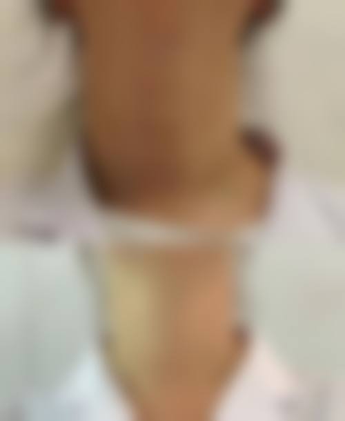 绵阳市人民医院烧伤整形科地理位置便于到院。