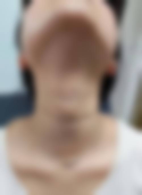 绵阳市人民医院烧伤整形科预约挂号方式。