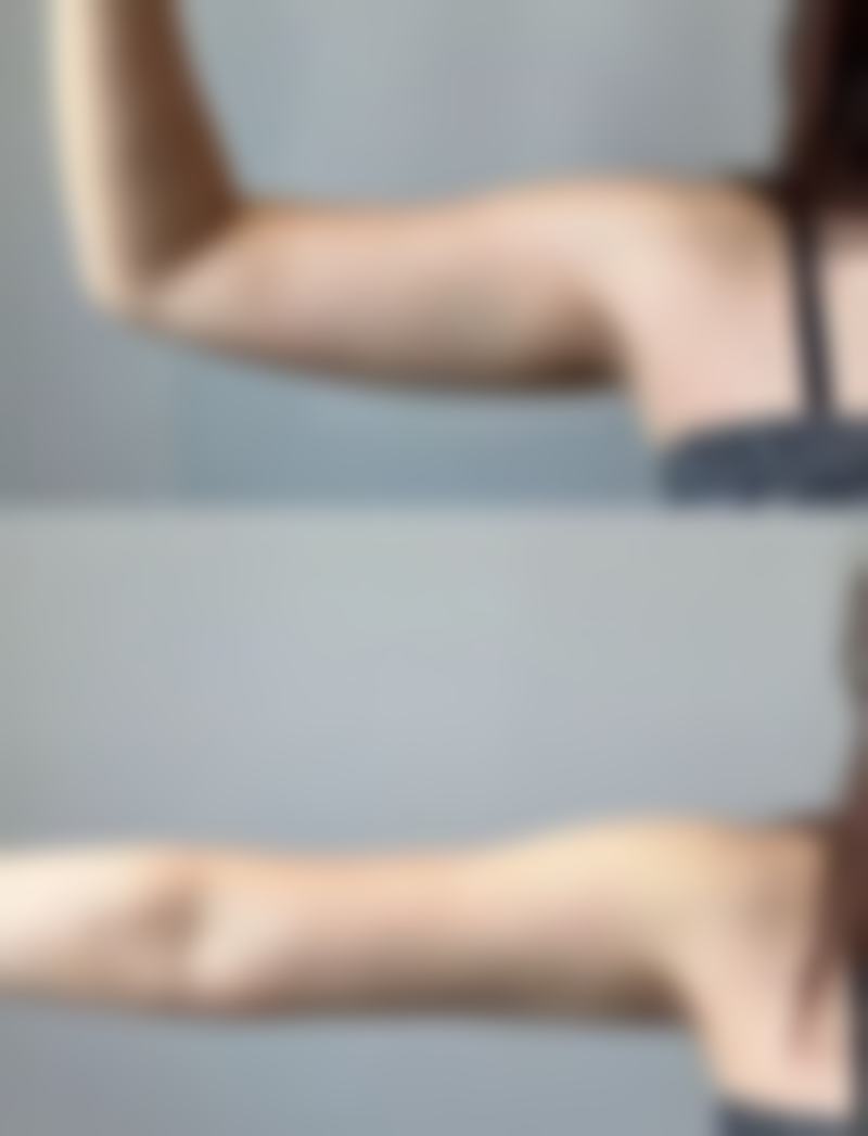 韓國句號整形外科怎麼預約掛號 適合邊類人群?港澳姊妹對號入座