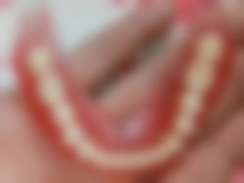 深圳河山口腔杜牙根技術:適合邊類人群?