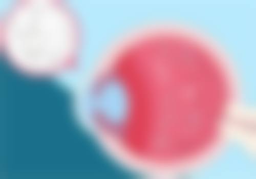 2、【全飞秒激光手术】核心技术优势