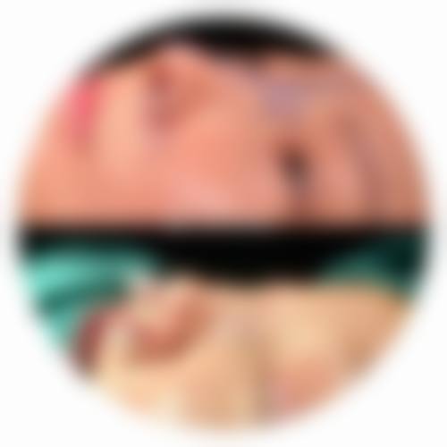 昆明圣雅医疗美容医院擅长项目。