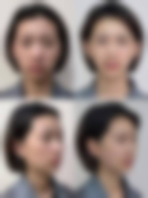 昆明圣雅医疗美容医院医生团队经验稳定。