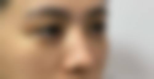 项目价格与优惠活动:透明消费,实惠变得更美