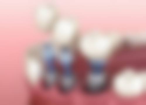 1、主要做的三大诊疗项目