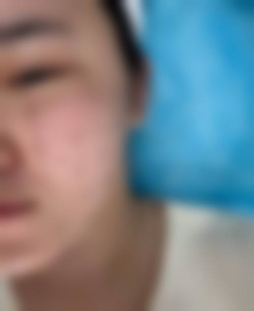 (1)眼部整形医生