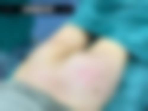 南方医 科 大学南方医院(整形美容外科)治疗反馈与口碑评价。