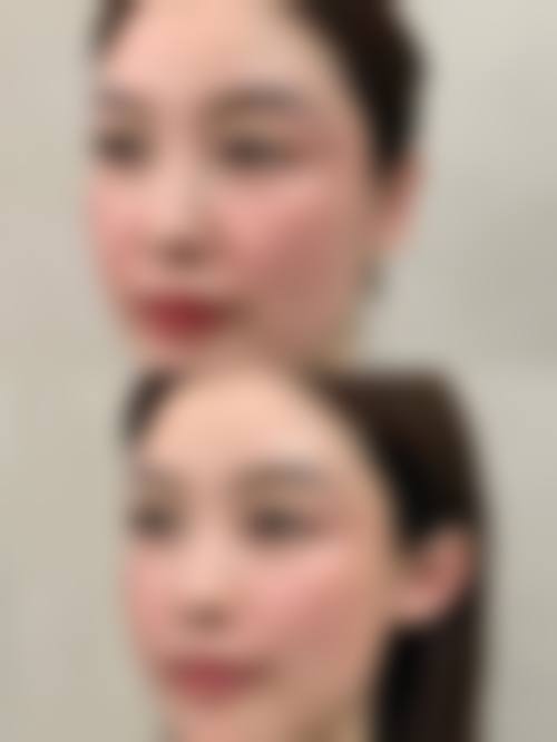 2、【比基尼线脱毛】核心技术优势