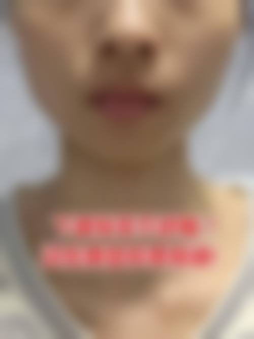 重庆科妍玑整形医院项目优势。