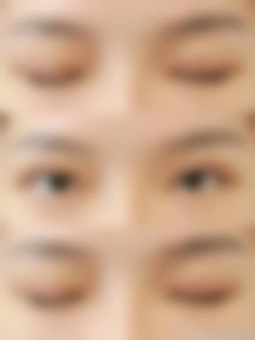 滕州美贝莱医疗美容诊所治疗反馈与口碑评价。