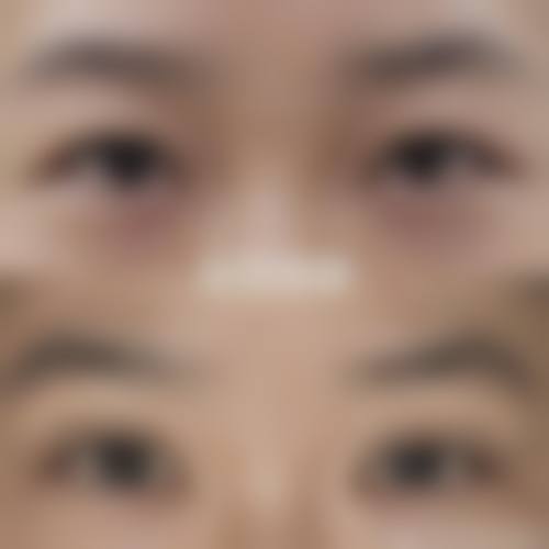 河南商丘普明眼科医院门诊营业时间。