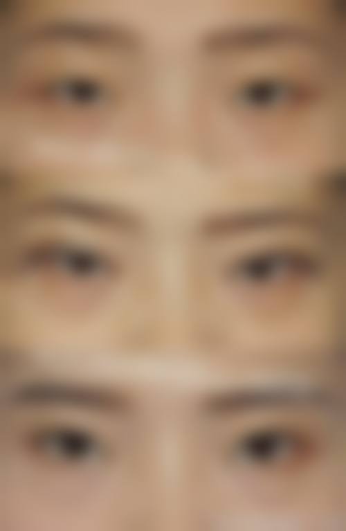 河南商丘普明眼科医院提供多种预约挂号方式。