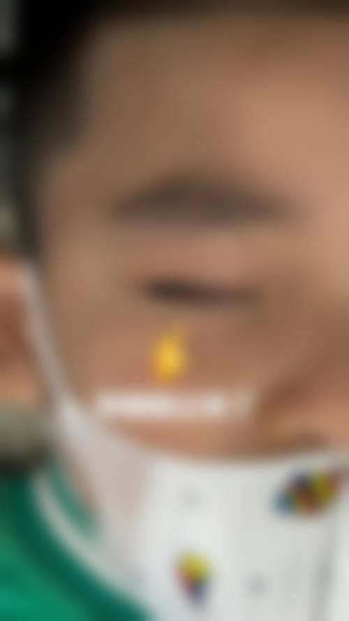河南商丘普明眼科医院擅长项目。