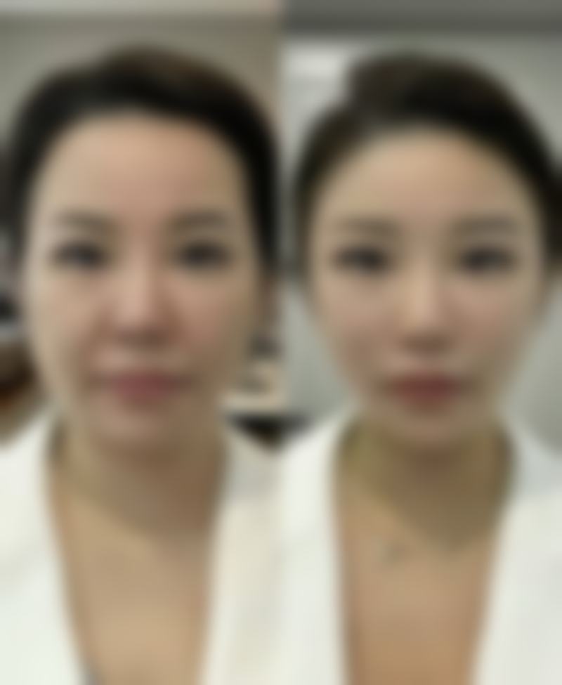 三、影响需白天使成效维持时间的因素