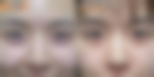 特色植发技术与项目：精细种植，自然浓密