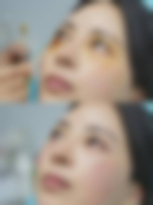 七、怎么判断自己是否适合韩式三点双眼皮