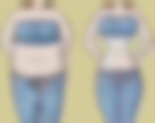 四、面部吸脂采用哪种方式更好