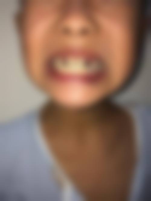 广东广州健达口腔擅长哪些项目？从种植到矫正全覆盖