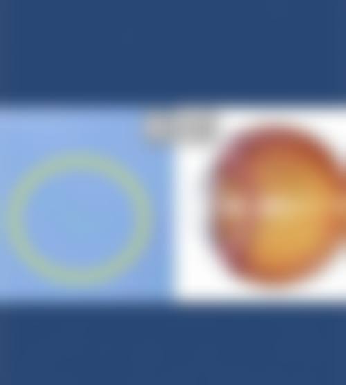 泸州市人民医院眼科擅长项目。
