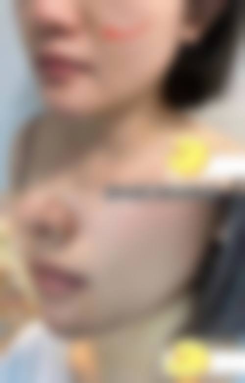 淄博妆典医疗整形美容门诊部擅长项目。