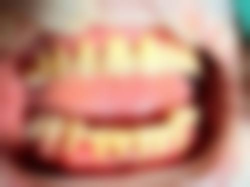 优惠活动详情:限时特别优惠,预约享低价