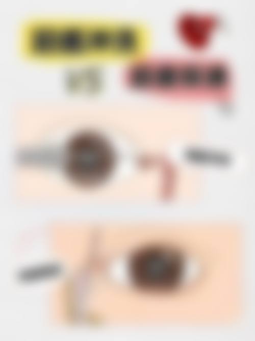 重庆市东南医院眼科医生团队经验稳定。