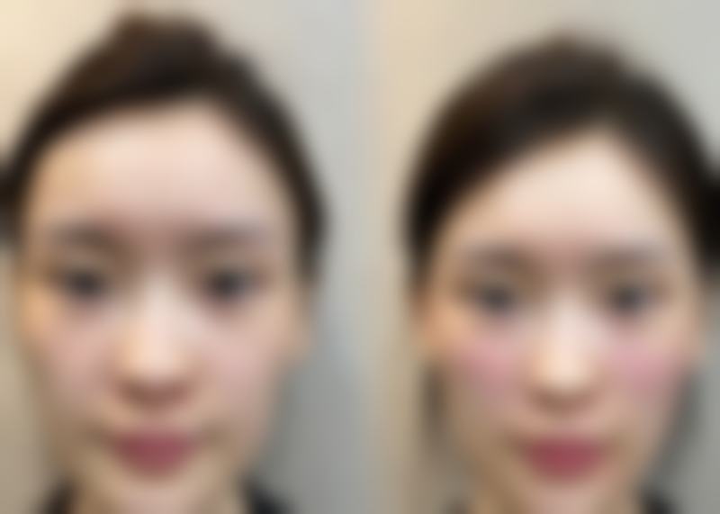 佳木斯李红石整形医疗美容科诊所地理位置便于到院。