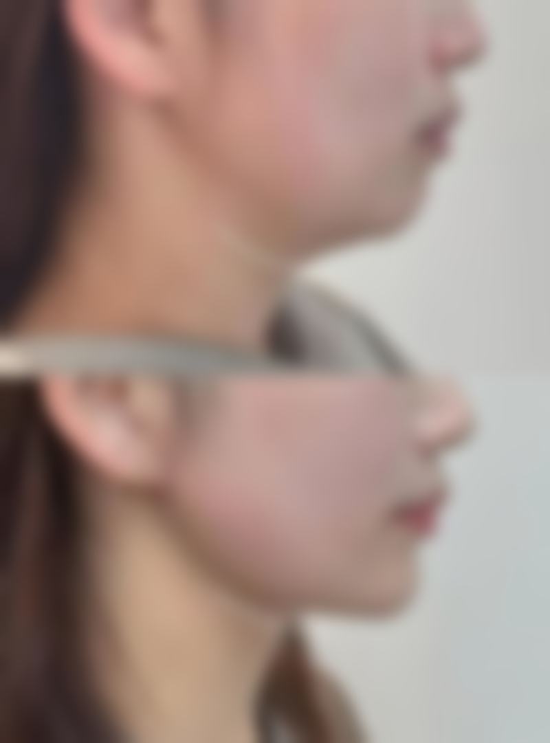 无锡江阴时光医疗美容门诊擅长项目。