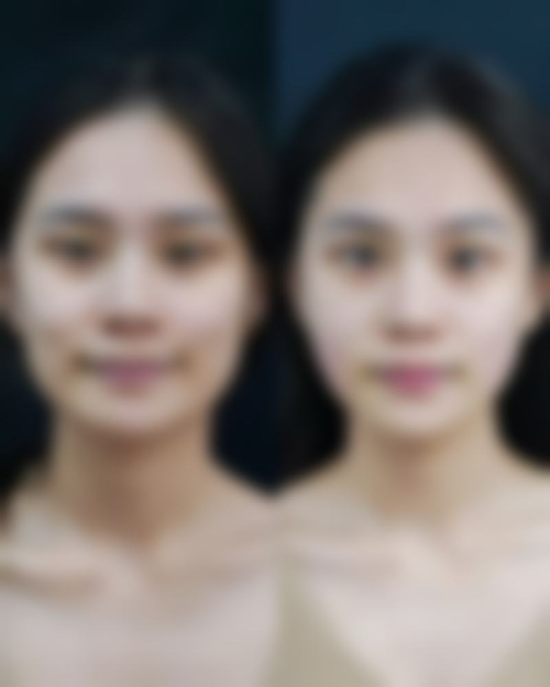 徐允虎医生口碑好不好?三位真实求美者的详细反馈