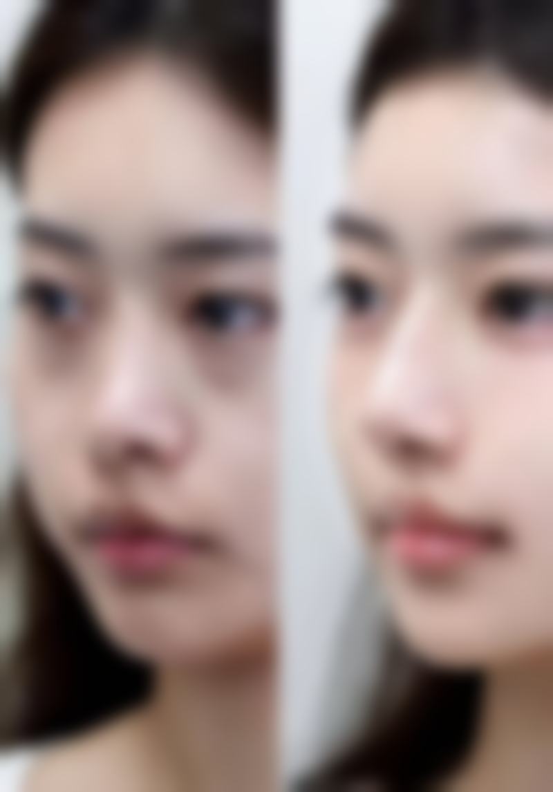 无锡江阴时光医疗美容门诊疗疗反馈与口碑评价。