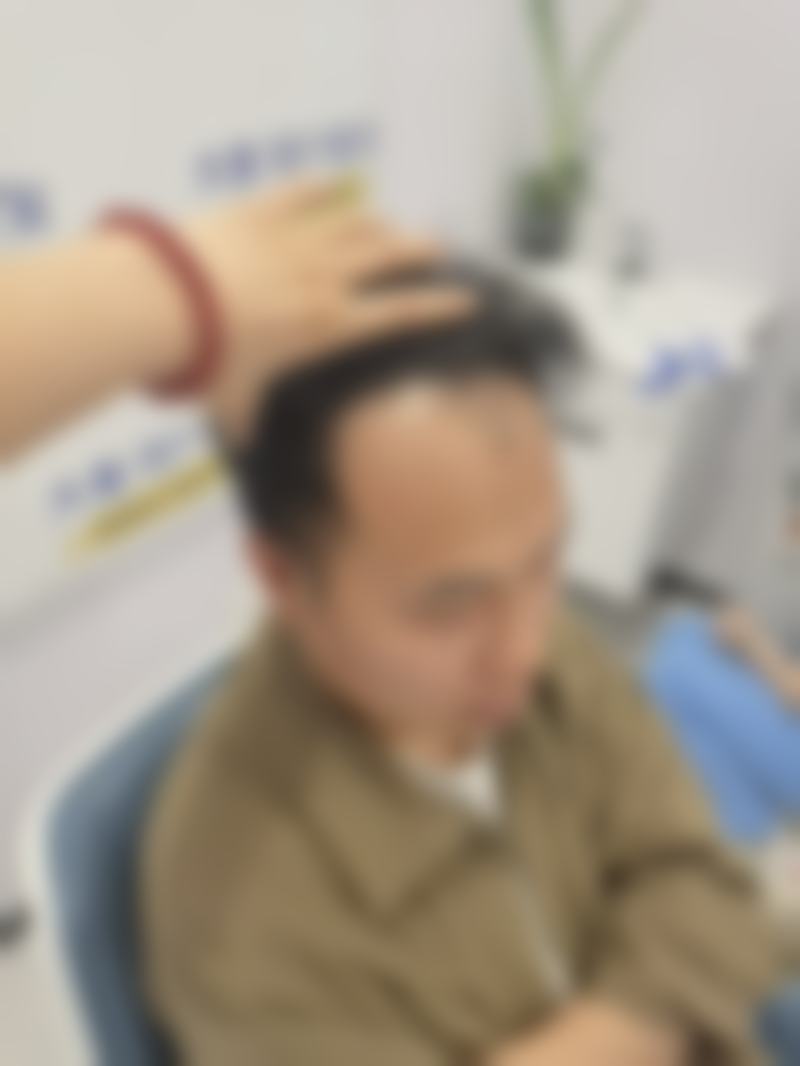 术后成效与感受